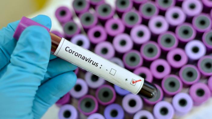     Coronavirus : cinq nouveaux cas et un décès 

