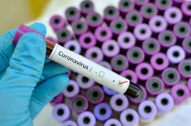     Coronavirus  : témoignage de Marie, premier cas de Guadeloupe

