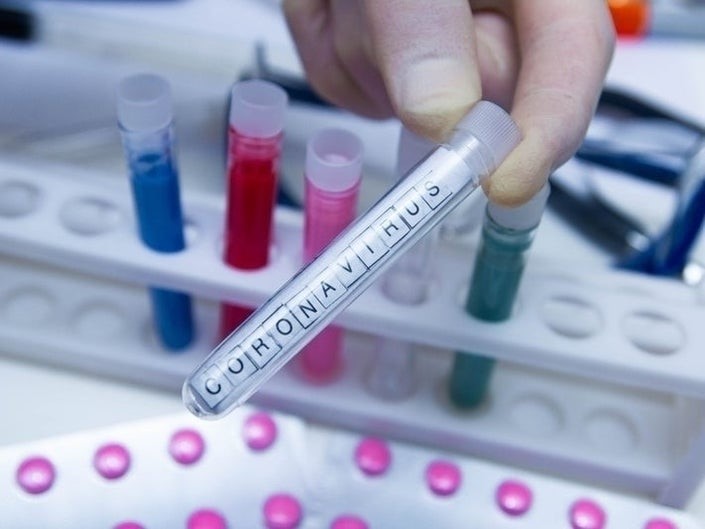     L'Institut Pasteur multiplie les tests de dépistage du coronavirus

