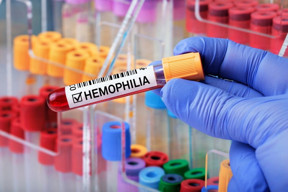     Journée mondiale de l’hémophilie : sensibilisation et prévention  

