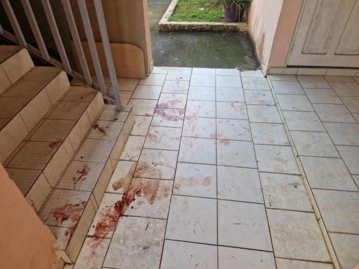 homicide 18 Case-Pilote