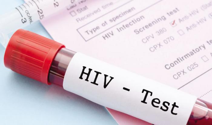     Des taux d'infection au VIH plus élevés aux Antilles-Guyane

