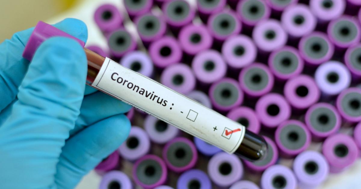     Coronavirus : le bilan en France fait état de 2 281 cas confirmés dont 48 décès

