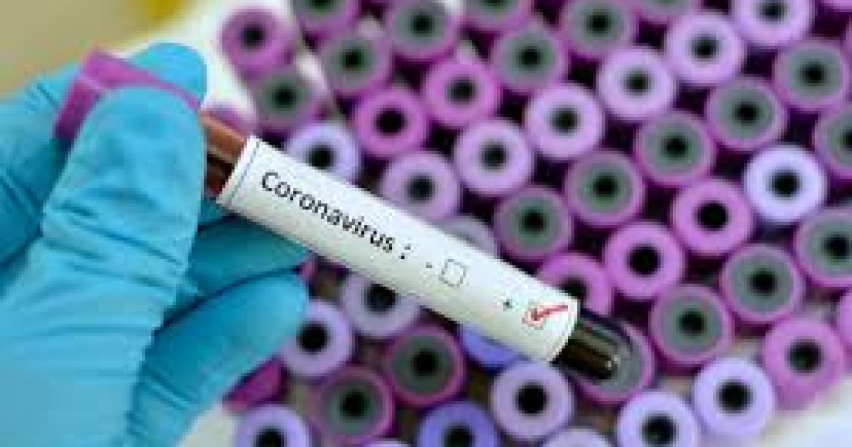     Coronavirus  : témoignage de Marie, premier cas de Guadeloupe

