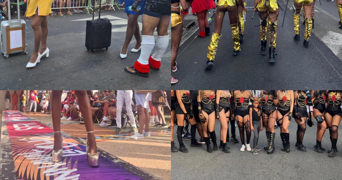     Carnaval : comment protéger vos pieds pendant les jours gras ?

