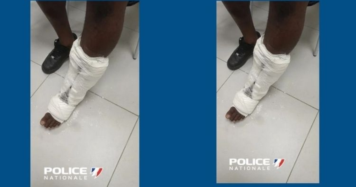     Arrêté à l'aéroport avec 3 kilos de cocaïne en guise de plâtre à la jambe

