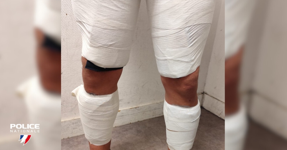     Fort-de-France/Roissy : une mule arrêtée avec 2,14 kg de cocaïne scotchés aux jambes

