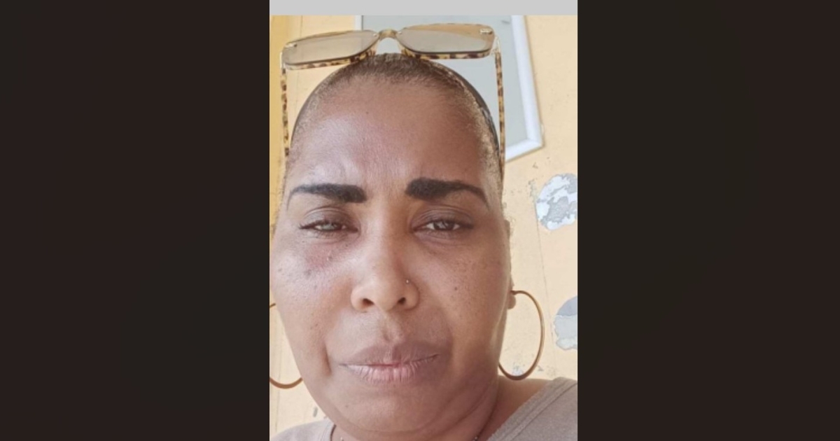     Appel à témoins : disparition inquiétante de Martine Clothilde Emboule à Pointe-à-Pitre

