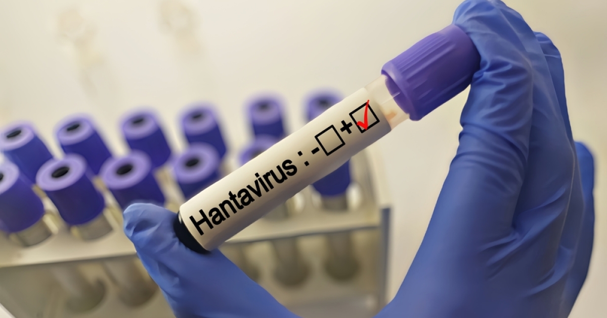     Hantavirus : un premier cas détecté en France, la crainte d'un « scénario Covid » ravive les inquiétudes

